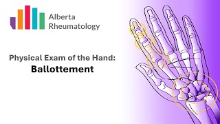 Rheumatology HAND exam Palpation for Joint Swelling [upl. by Acinet]