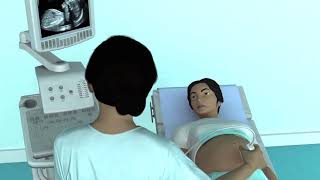 The Basic Steps of an Obstetric Ultrasound Examination [upl. by Mixie]