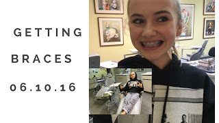 I GOT BRACES  VLOG [upl. by Tor]