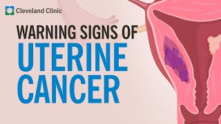 The Most Common Warning Sign of Uterine Cancer [upl. by Neelloc479]