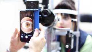 Slit Lamp iPhone Photography 3 essential steps [upl. by Ander859]