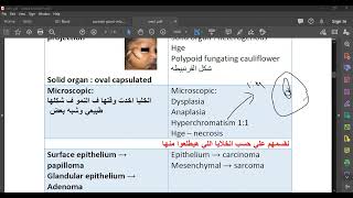 L25 Pathology Salivary Gland Tumors 1 [upl. by Leeke]