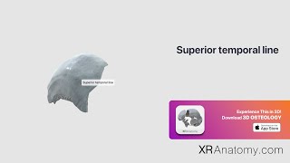 Parietal Bone  Superior temporal line [upl. by Hopfinger]