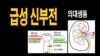 급성신부전Prerenal AKI 의사의대생용 [upl. by Siclari]