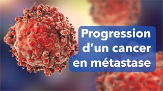 Cancer en progression  mécanisme dune métastase [upl. by Schoenburg]