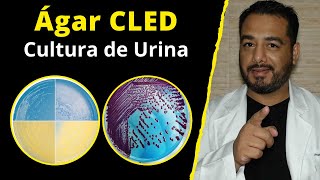 13 Ágar CLED Meio de Cultura Urina  Urocultura  Microbiologia  Questões Concurso Público [upl. by Trakas]