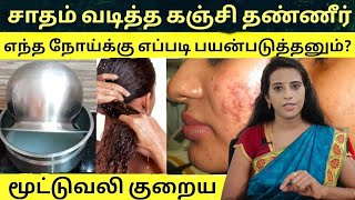 சாதம் வடிக்குற கஞ்சி தண்ணீர் எந்தெந்த நோய்க்கு எப்படி பயன்படுத்தனும் Rice water benefits in tamil [upl. by Lean]