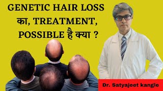 Genetic Hair Loss Treatment  Dr Satyajeet Kangle [upl. by Stanwinn]