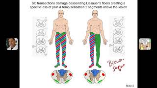 Clinical Significance of Lissauers tract [upl. by Nylyaj773]