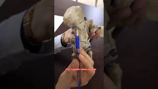 talus calcaneus ve diğer ayak kemikleri anatomisi [upl. by Ellicec]