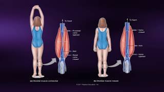 Causes of Muscle Soreness  Coursera Science of Exercise [upl. by Esyli725]