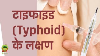 टाइफाइड Typhoid के लक्षण  Symptoms of Typhoid Fever  Dr Pawanindra Lal  Hindi  healthyho [upl. by Ettenrahc368]