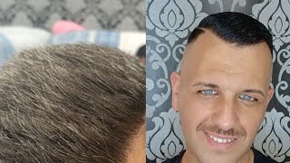 Come coprire i capelli bianchi fai da te uomo in 5 minutiSchwarzkopf Men Perfect Colorante in Gel [upl. by Sulihpoeht842]