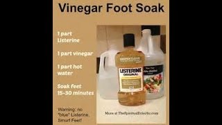 RESULTS Does Soaking Your Feet In Listerine amp Vinegar Make Them Extra Soft [upl. by Wachtel297]