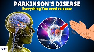 Parkinson’s Disease – Causes Signs and Symptoms Diagnosis amp Treatment [upl. by Nnylatsyrk405]