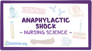 Anaphylactic shock Clinical Nursing Care [upl. by Eicnahc924]