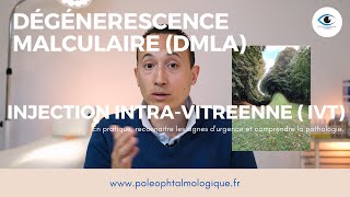 Dégénérescence maculaire liée à lâge DMLA et injection intravitréene IVT Pole Ophtalmologique [upl. by Vivien427]