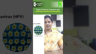 Are WARTS CONTAGIOUS Warts Homeopathy Alternative Medicine CureDrV BhagyalakshmiDoctors Circle [upl. by Azmuh]