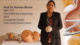 Prof Dr Noreen Akmal  Forceps Delivery Part 1 [upl. by Anam492]