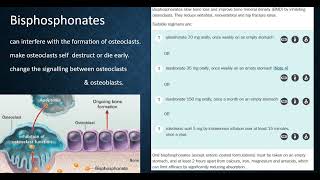 Osteoporosis Bisphosphonates Alendronate Risedronate Zoledronic acid Roze pharm [upl. by Renick]