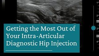 10 Tips for Getting the Most Out of Your IntraArticular Diagnostic Hip Injection [upl. by Haimes]