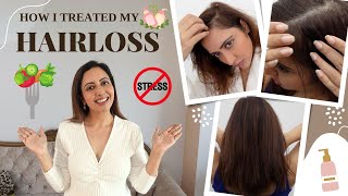 How I treated my thinning hair and hairloss  Garima’s Good Life [upl. by Aned]