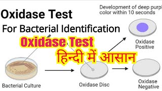 Oxidase test in hindi  Bacterial identification  Microbiology [upl. by Coh]