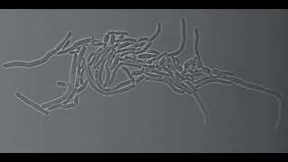 Multiple fission in Corynebacterium matruchotii [upl. by Achorn]