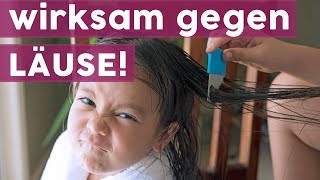 5 Hausmittel gegen Kopfläuse 🧒 MOMLIFE [upl. by Halyhs]