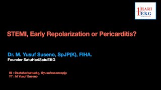 STEMI NSTEMI or Early Repolarization Pattern De Winter Sign Hyperacute T 4 Variable Formula [upl. by Nolrac]