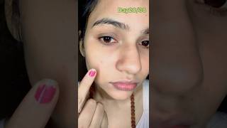 Day 2030 spotless skin challenge  skincare series  shorts skincare glowingskin youtube [upl. by Paschasia]