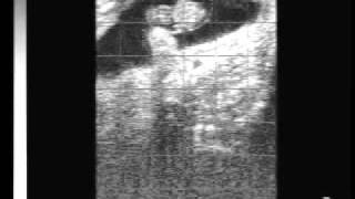 Bovine pregnancy 40 days with EasiScan ultrasoundwmv [upl. by Castro]