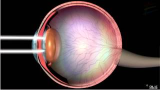 Structure and Working of Human Eye [upl. by Anthiathia]