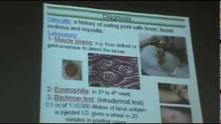 DrAzza Parasitology  Nematodes 6  Tissue Nematodes [upl. by Sinai]