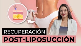 Liposucción Claves para EVITAR la FIBROSIS y prolongar los resultados [upl. by Nahshun]