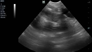 Pyometra in cat ultrasound rahim iltahabı [upl. by Sardella]