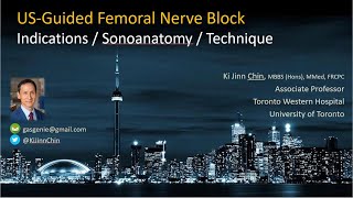 Ultrasoundguided Femoral Nerve Block [upl. by Munsey344]