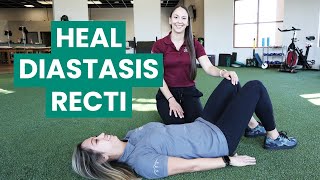 Exercises to Fix Your Diastasis Recti  Physical Therapy [upl. by Ansell]