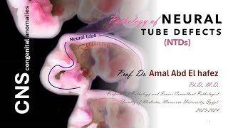 Congenital anomalies of CNS lecture 1 شرح محاضرة [upl. by Aiva]