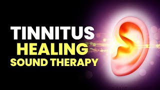 Tinnitus Healing Sound Therapy  Get Relief from Ear Pain  Overcome Hearing Loss amp Ear Injury [upl. by Nnylodnewg]