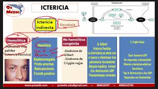 Qx gastroenterologia  SINDROME ICTERICO [upl. by Ahsinahs965]