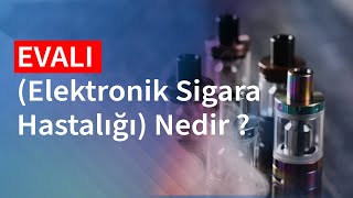 Elektronik Sigaranın Zararları Nelerdir  Medical Park [upl. by Blessington808]