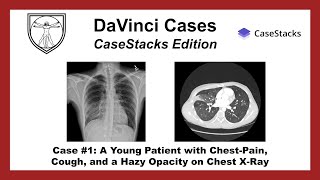 Chest XRay and Chest CT Interpretation [upl. by Ecallaw]