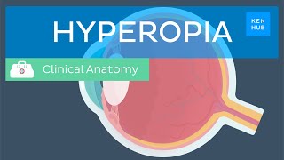 Farsightedness Hyperopia Definition causes symptoms diagnosis and treatment  Kenhub [upl. by Owens]