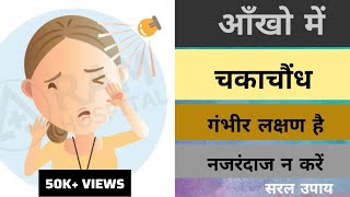 आँखो में चकाचौंध गंभीर लक्षण है। नजरंदाज न करें । shubhameyecare photophobia [upl. by Erreit575]