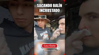 😱SACANDO BALÍN INCRUSTADO😱 ▬ CORRECTO PROCEDIMIENTO ▬ airsoft gameplay shorts [upl. by Loutitia879]