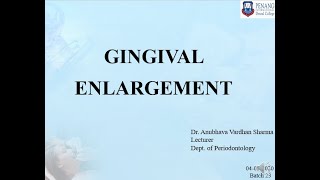 GINGIVAL ENLARGEMENT [upl. by Rolyab]