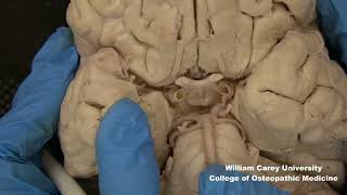 Ventral brainstemhypothalamus neuroanatomy hypothalamus brainstem anatomymedicalstudentbrain [upl. by Eleaffar355]