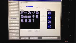 siemens acuson s3000 configration [upl. by Ackley]