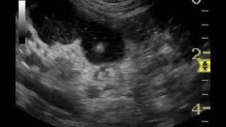 Ultrasoundguided needle biopsy of a jejunal lymph node in a dog [upl. by Azer]